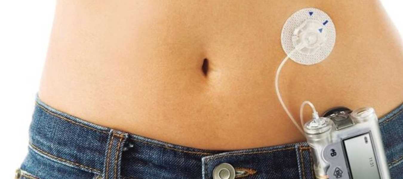 Featured Image 30279