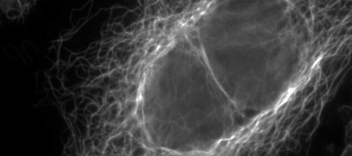 Featured Image 33223