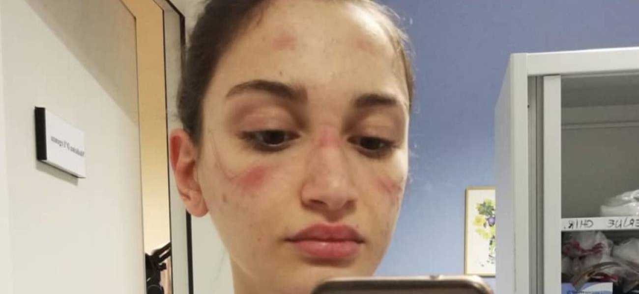 Featured Image 36803