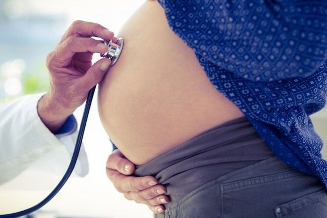 Embarazo covid salud