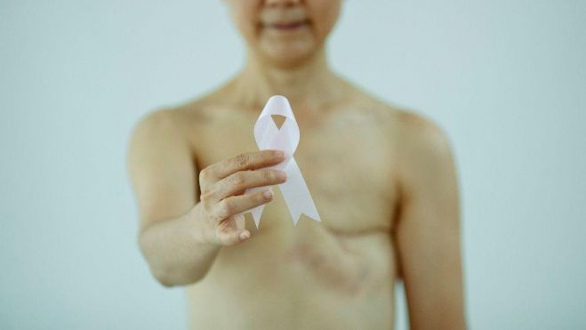 Enferma de cáncer de mama./ Enferma de cáncer de mama./