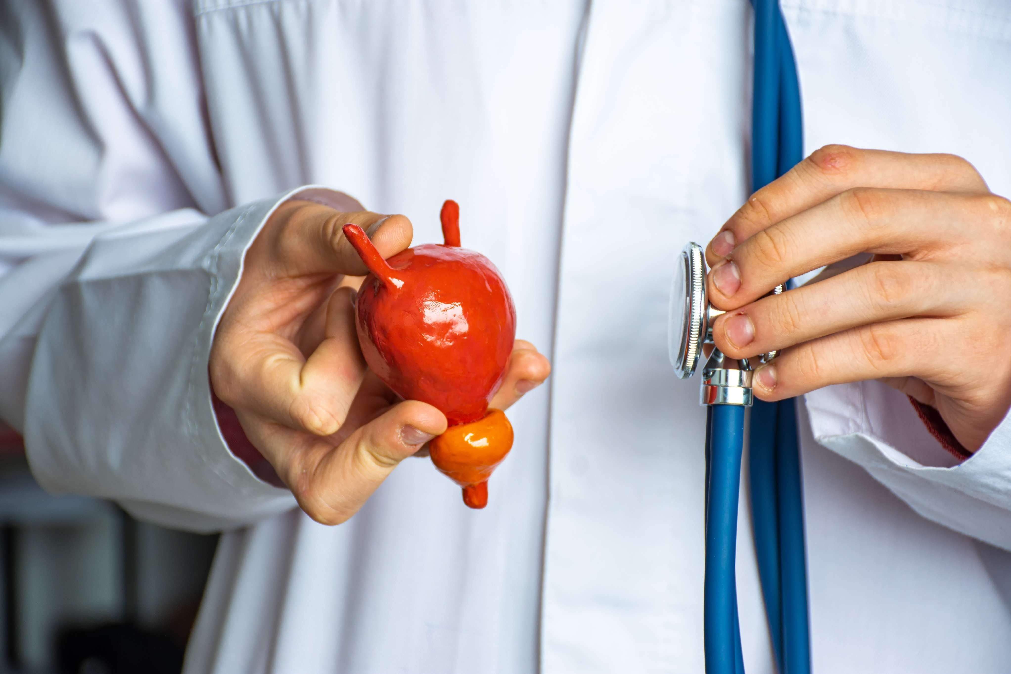 Un médico sostiene el modelo de vejiga urinaria humana con próstata y un estetoscopio. Hoy se celebra el Día Europeo de la Salud Prostática / EP