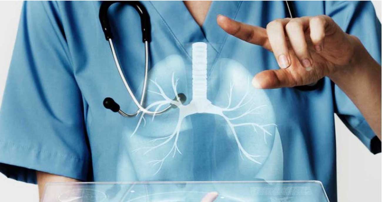 Simulación de un pulmón. La fisioterapia cardiorrespiratoria es una disciplina que previene, trata y estabiliza las disfunciones de la respiración / ARCHIVO