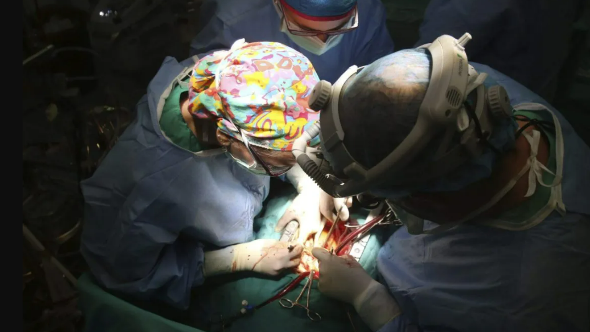 Imagen de un transplante. /Efe