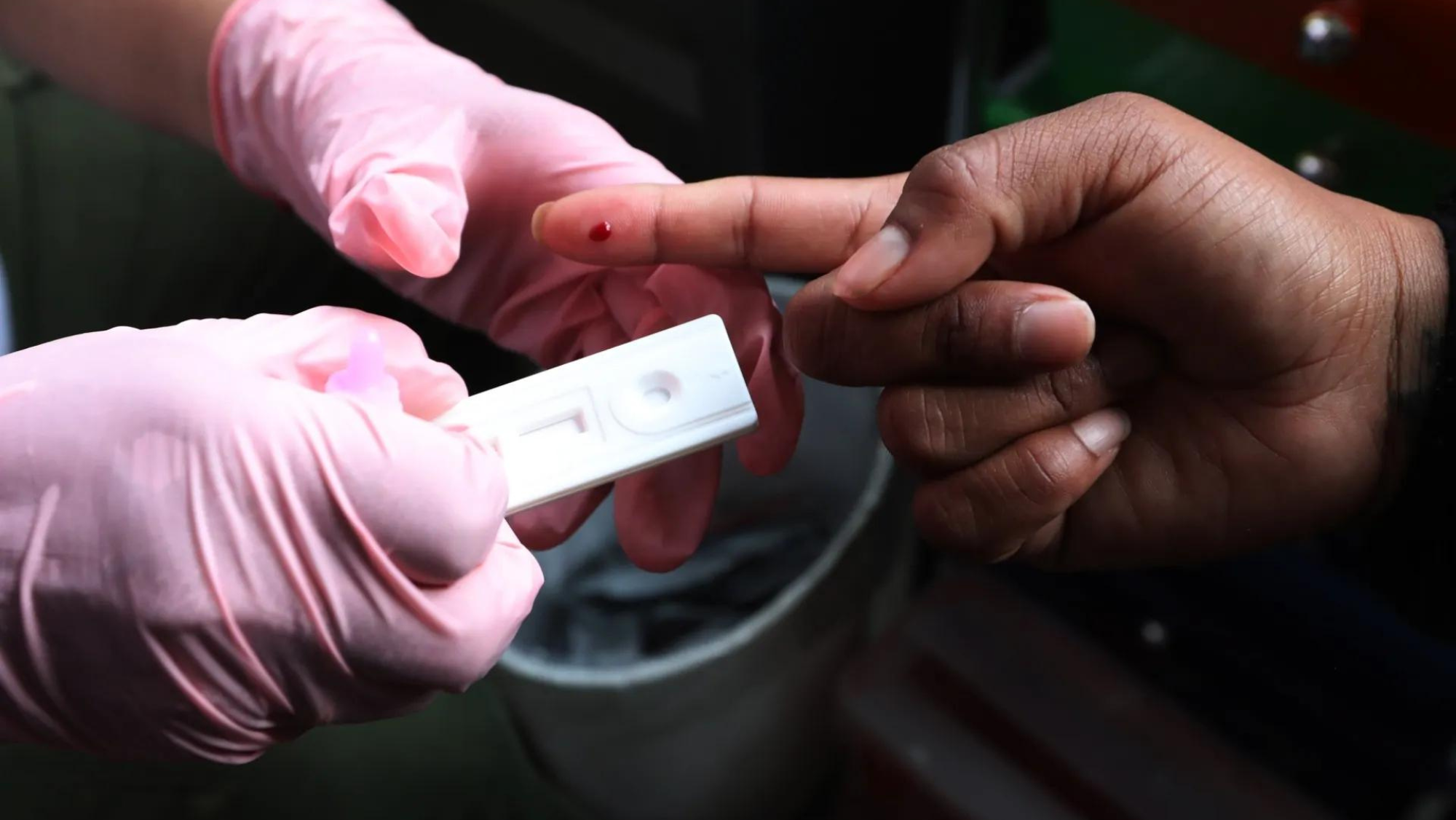 Una prueba diagnóstica de VIH (sida). /EFE