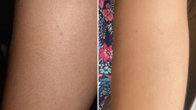 Imagen de los pinchazos el día del Boombastic y el día siguiente / REDES