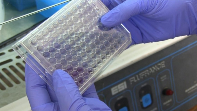 Inmunoterapia contra las células tumorales / EFE