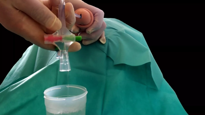 La sonda / RETHINK MEDICAL