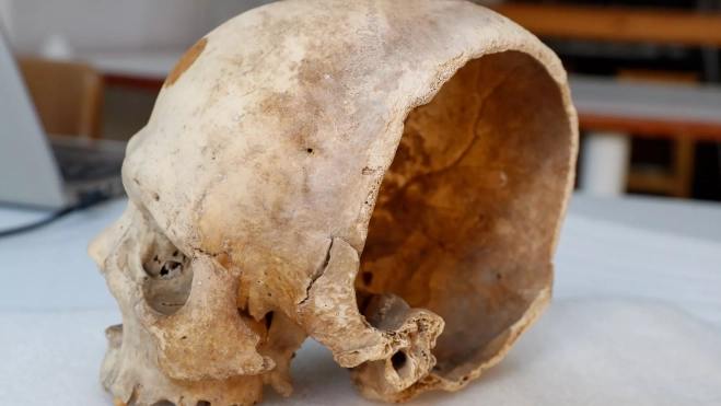 La herida de espada en el cráneo demuestra que Canarias se relacionó con otras sociedades / EFE - ELVIRA URQUIJO