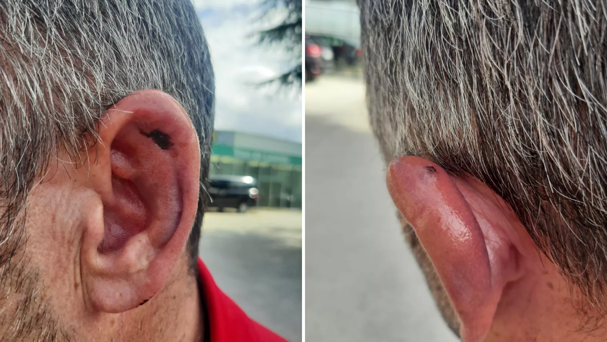 Imágenes de los golpes en la oreja del aficionado agredido / CEDIDAS - ATLÁNTICO HOY