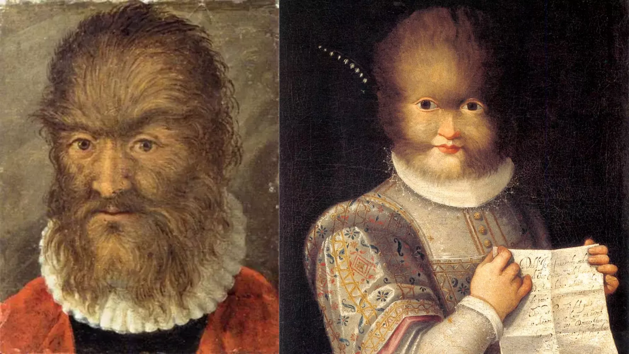 Imagen de Pedro González de adulto y de niño, personaje que inspiró La Bella y la Bestia / MONTAJE DE RETRATOS AH