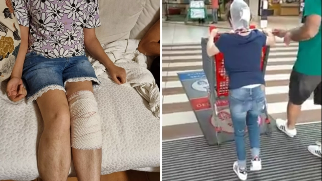 Imágenes de dos usuarias con diferentes heridas tras pasar por el centro sociosanitario de Las LonguerasMONTAJE AH