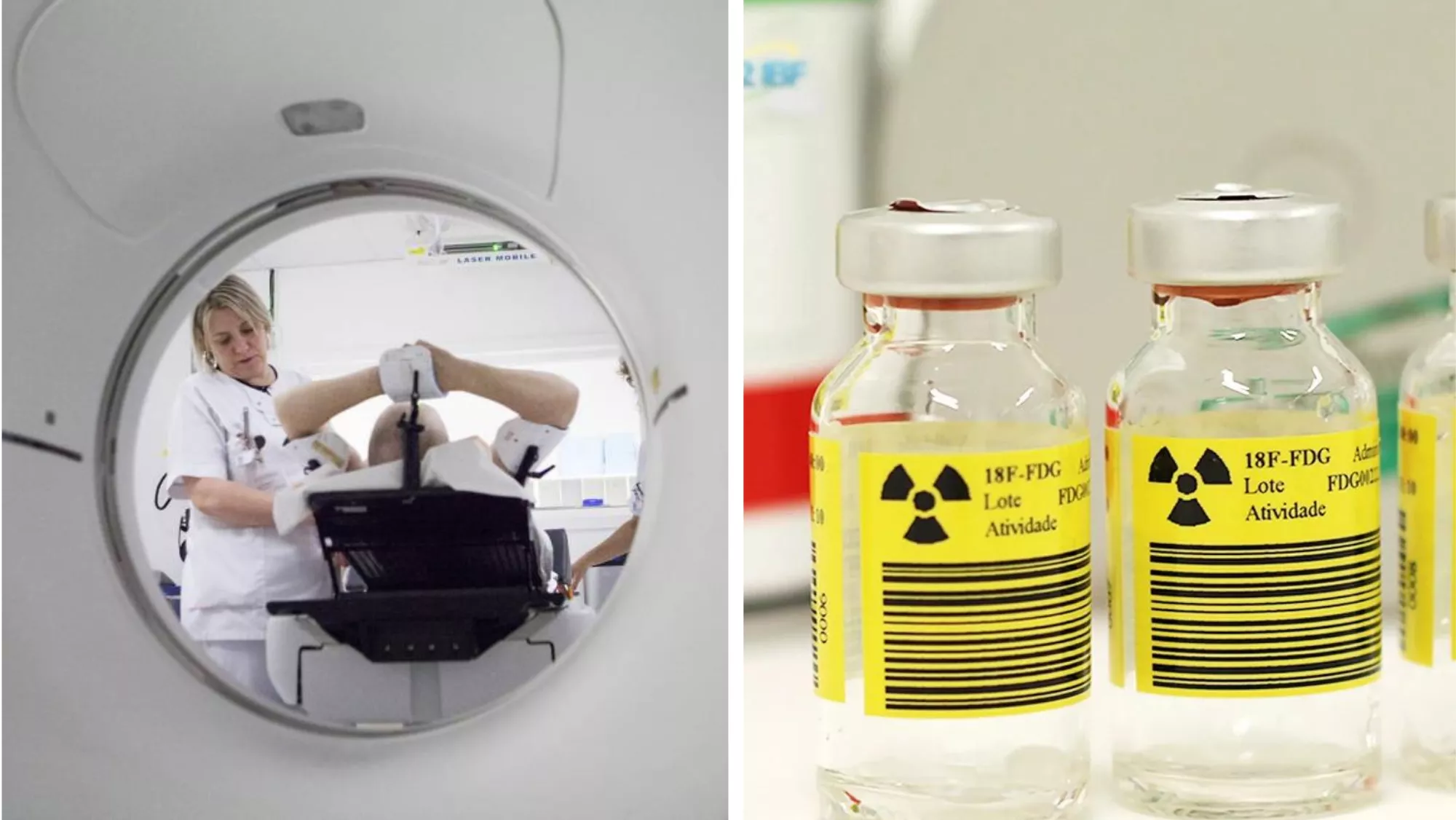 Montaje con imágenes de un PET/TC y frascos con radiofármaco 18F-FDG, el medicamento utilizado para detectar cáncer. / AH
