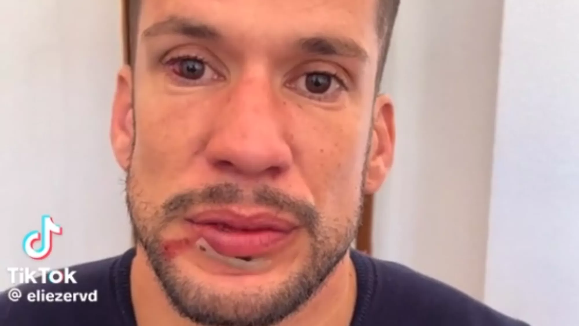 Un hombre denuncia una agresión homófoba en una discoteca / REDES