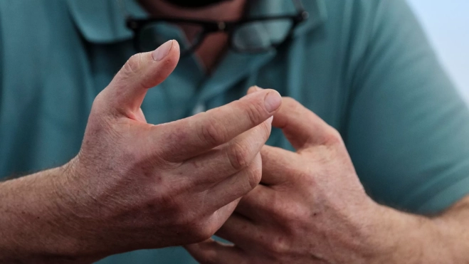 Las manos de Ramón, el primer paciente de Canarias que supera el temblor esencial con ultrasonidos / EFE - ÁNGEL MEDINA