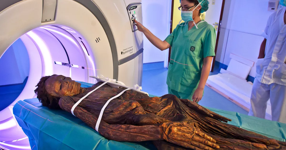 La momia guanche de Tenerife fue sometida a un TAC en 2019 para determinar su estado de conservación. / MAN