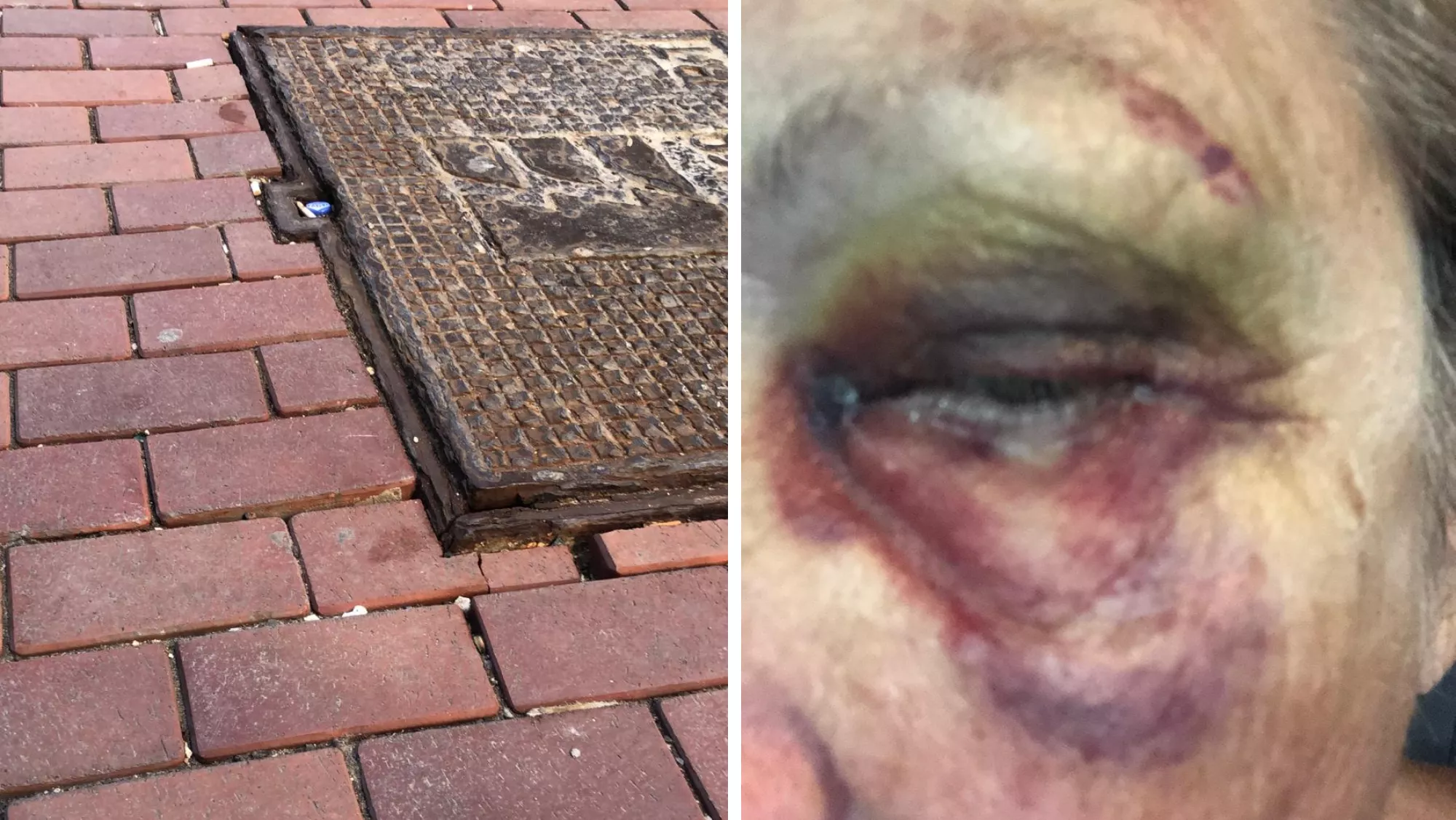 A la izquierda, la alcantarilla en mal estado; a la derecha, el ojo de la mujer accidentada / MONTAJE AH