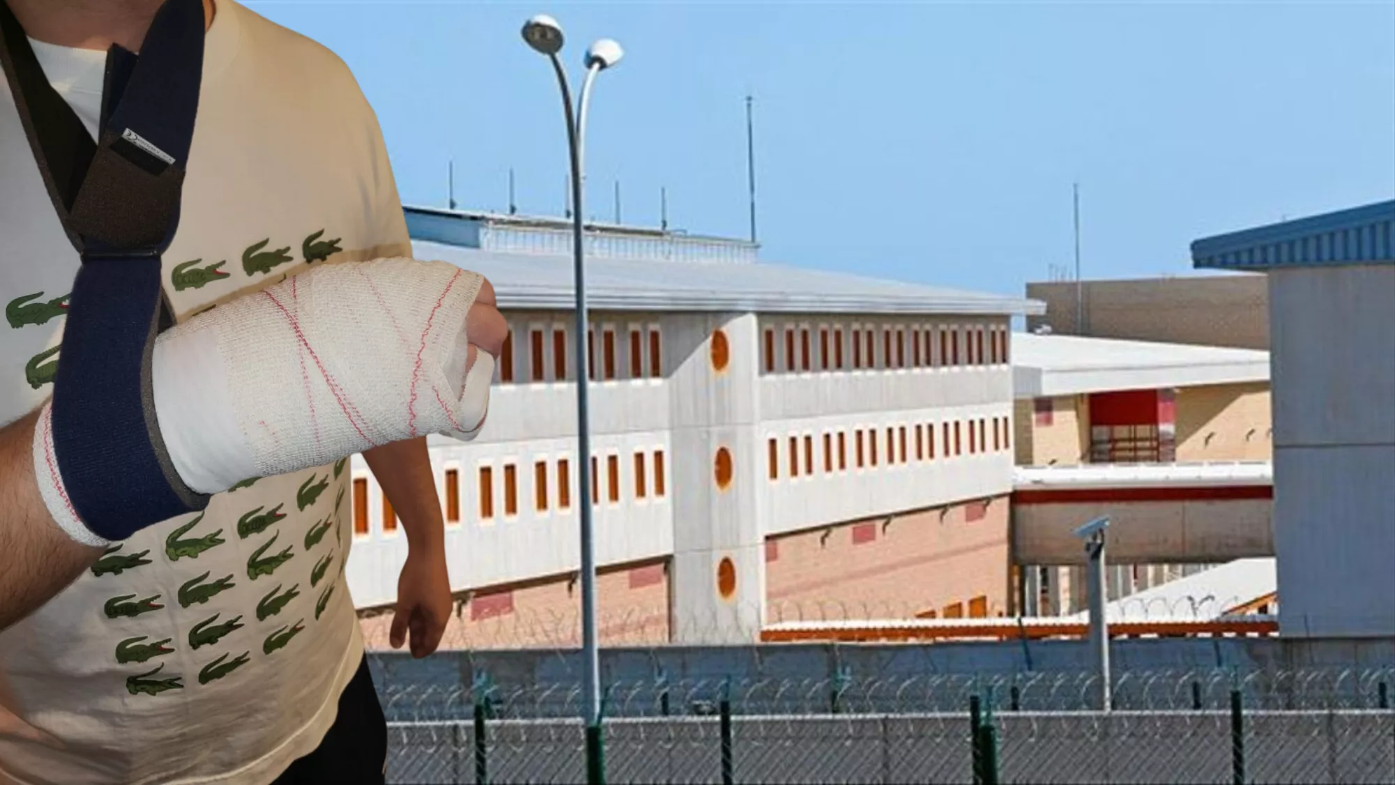 Un funcionario de prisiones con la mano rota en la prisión Las Palmas II./ MONTAJE AH