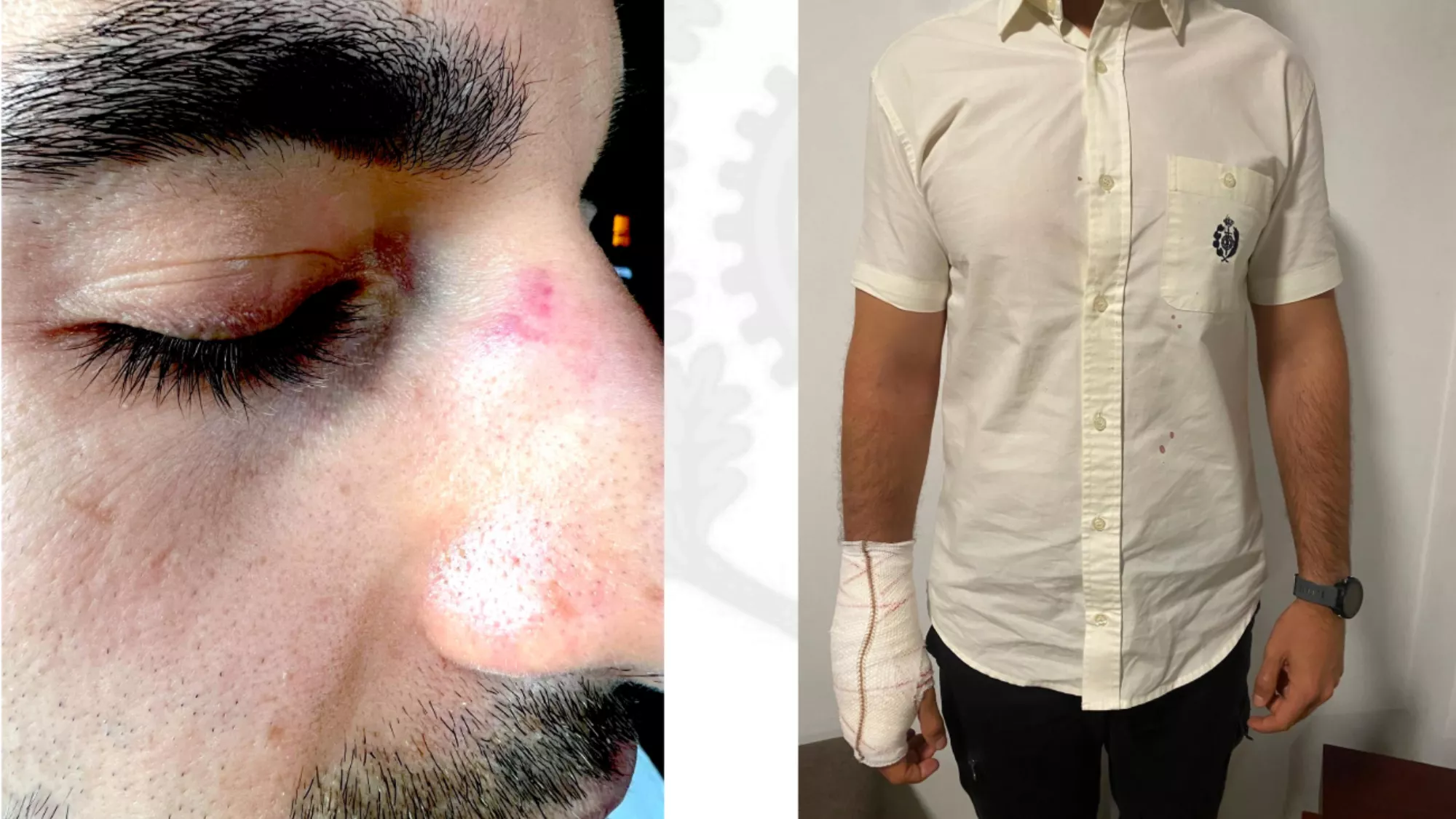 Funcionarios de prisiones heridos en Las Palmas II./ CEDIDA