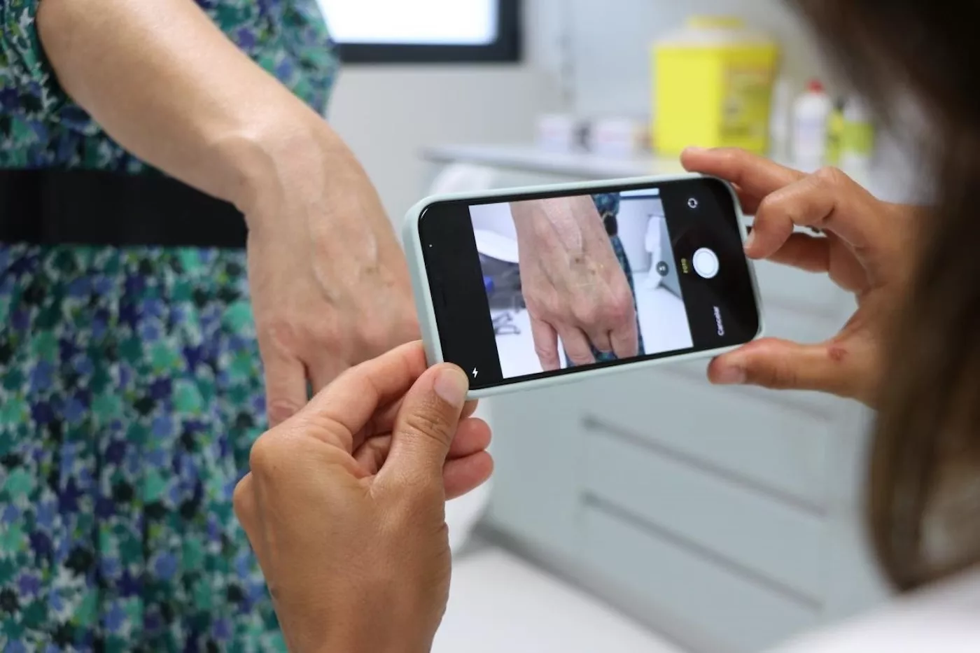 Una especialista realiza el seguimiento digital de lesiones en la piel de una paciente a través de una aplicación móvil