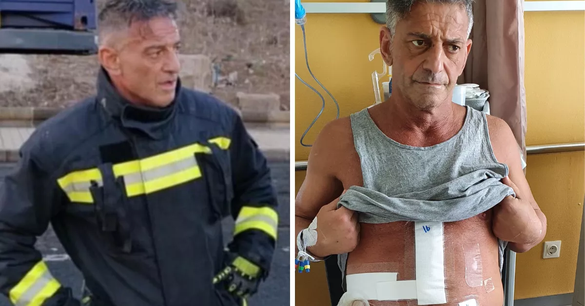 La Justicia confirma que el Ayuntamiento no protegió al bombero que se jugó la vida por un menor. A la izquierda el bombero Pedro Sosa antes del accidente laboral y a la derecha después de una de sus operaciones / AH