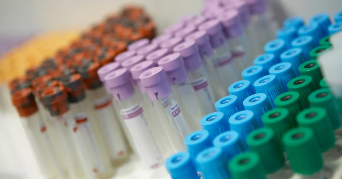 Tubos de muestra de sangre. / GOBIERNO DE CANARIAS