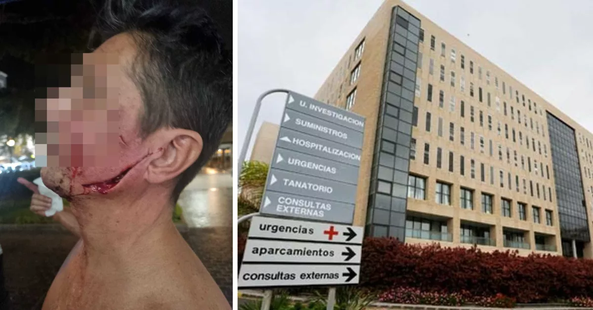 Debido a las heridas tras el ataque, el hombre tuvo que ser trasladado al Hospital Doctor Negrín / AH Debido a las heridas tras el ataque, el hombre tuvo que ser trasladado al Hospital Doctor Negrín / AH