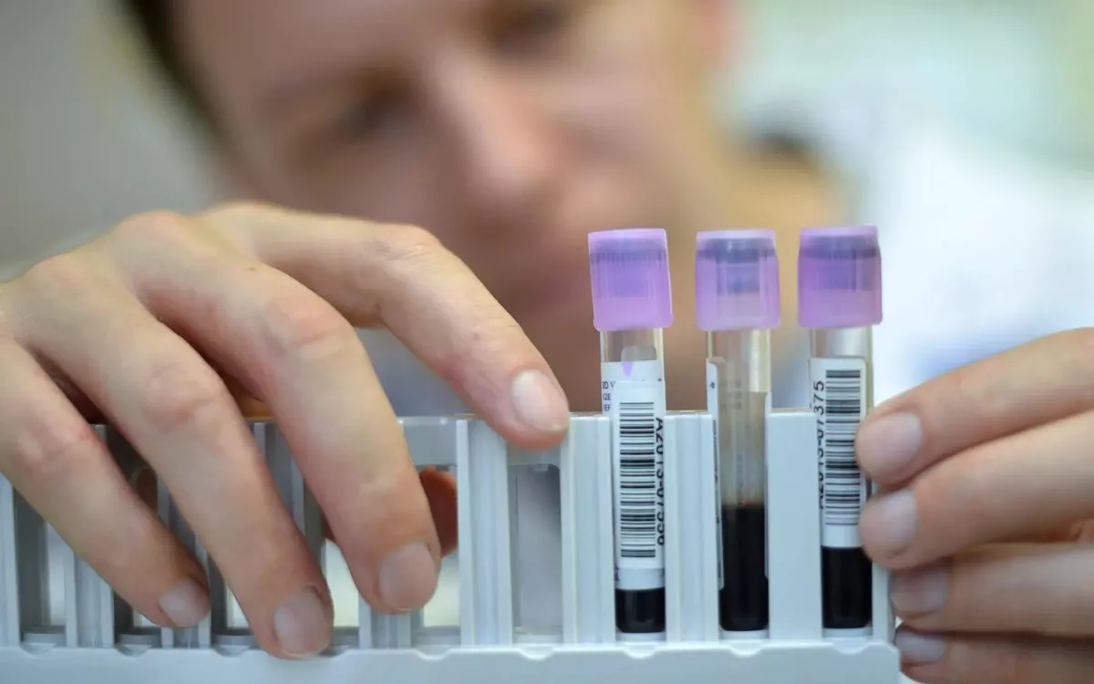 Canarias triplica los casos de hepatitis A en tres años. En la imagen, un técnico enseña muestras de orina y sangre. / CHRISTIAN BRUN-EFE Canarias triplica los casos de hepatitis A en tres años. En la imagen, un técnico enseña muestras de orina y sangre. / CHRISTIAN BRUN-EFE