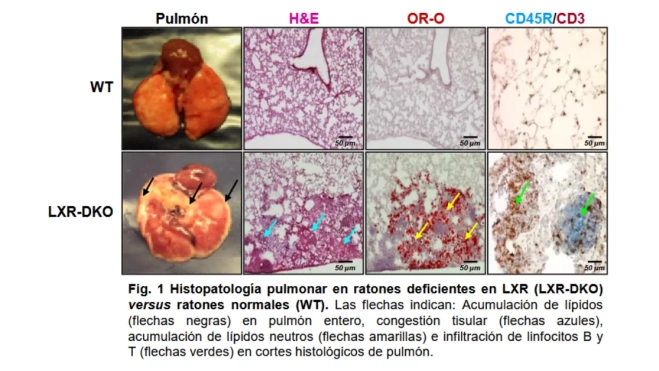 Imágenes de los resultados de las investigaciones en ratones con y sin deficiencia de LXR / ULPGC Imágenes de los resultados de las investigaciones en ratones con y sin deficiencia de LXR / ULPGC