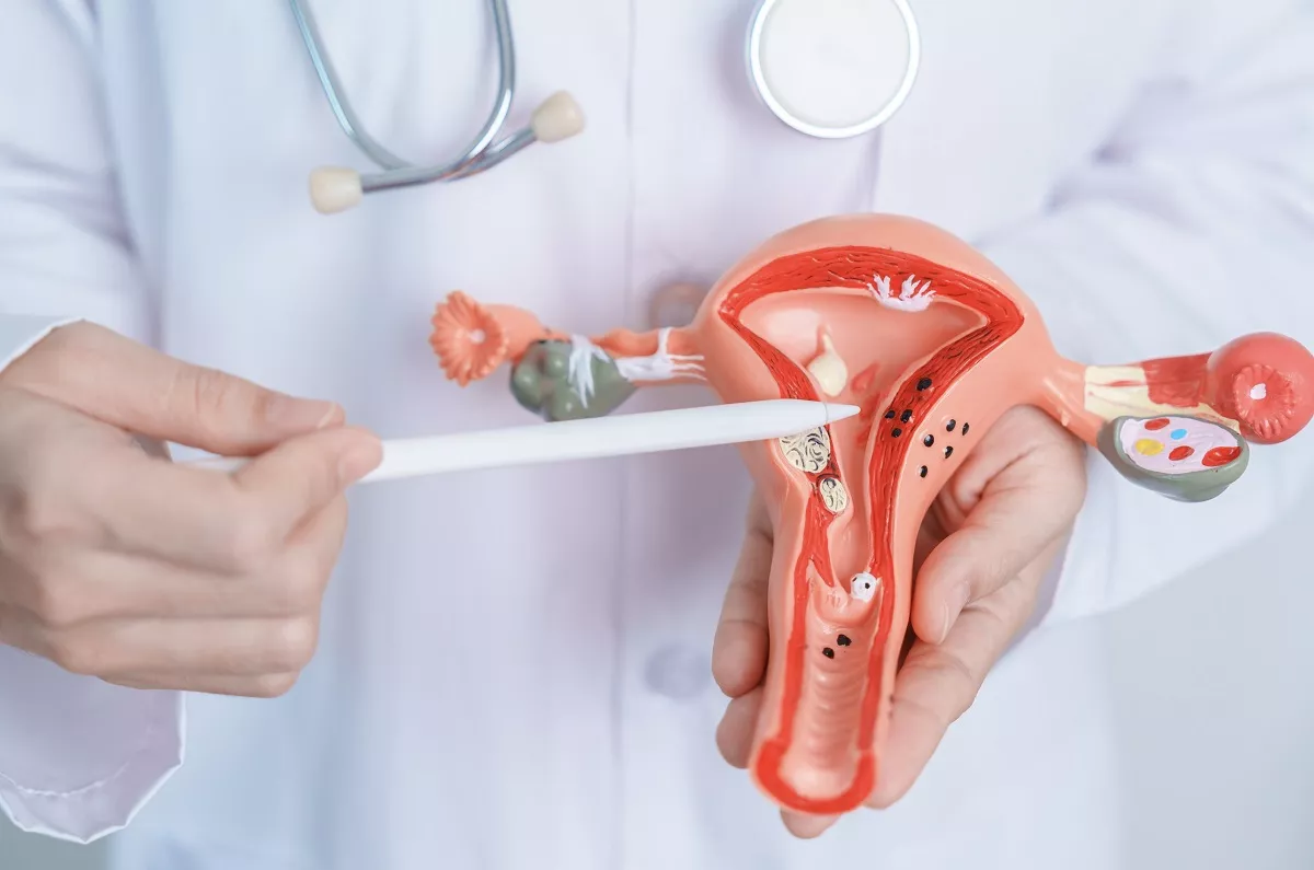 El cáncer de útero se puede curar si se detecta a tiempo / EUROPA PRESS