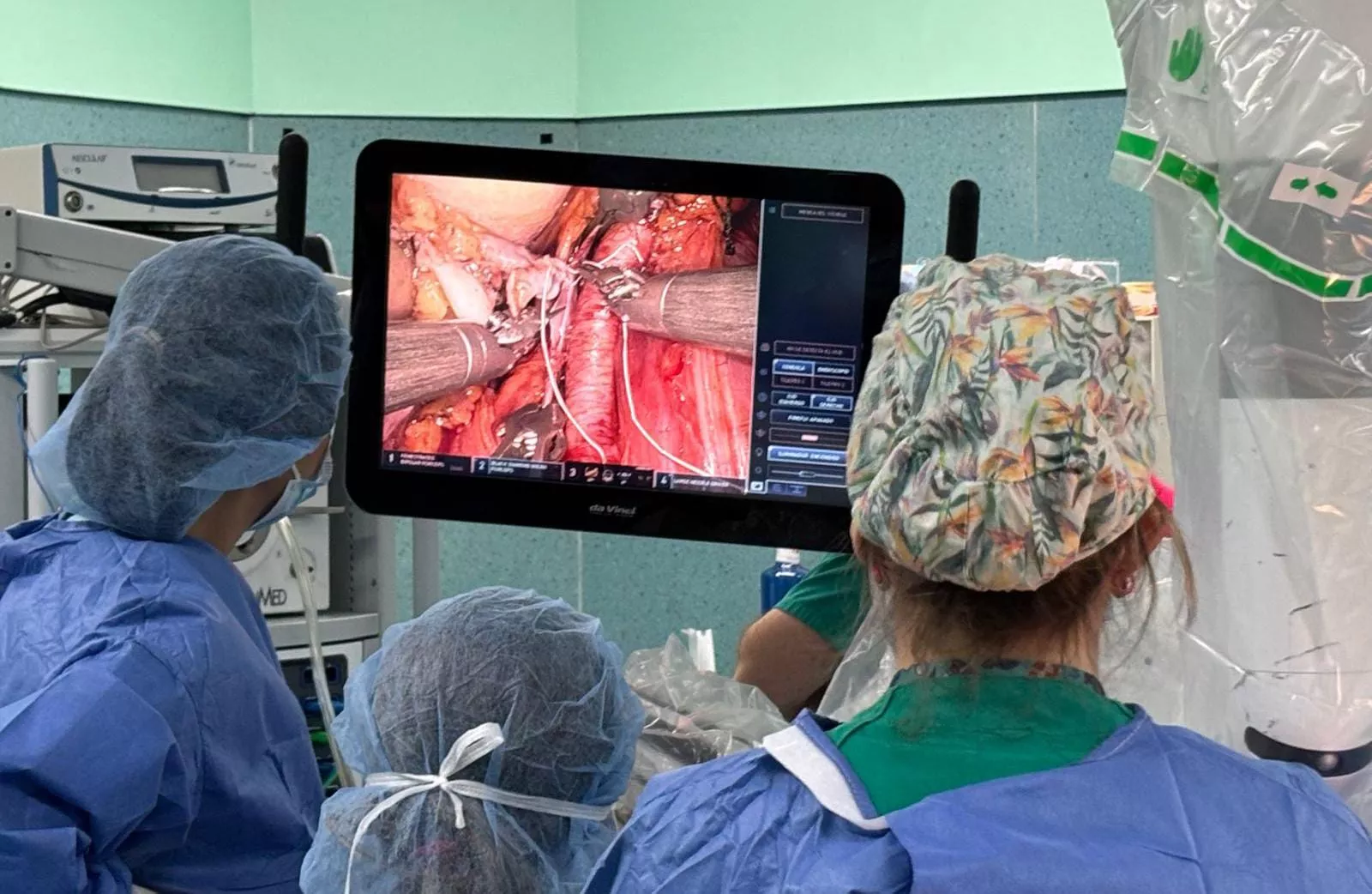 Trasplante de riñón con cirugía robótica. /HUC