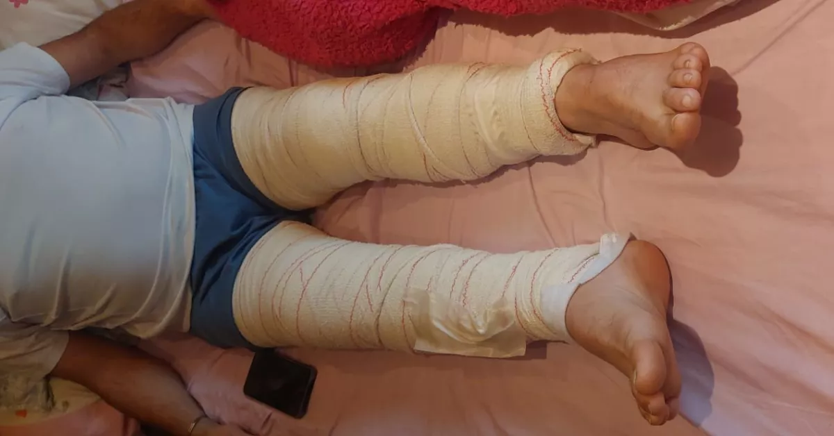 Jorge Amaro, ciclista accidentado | CEDIDA