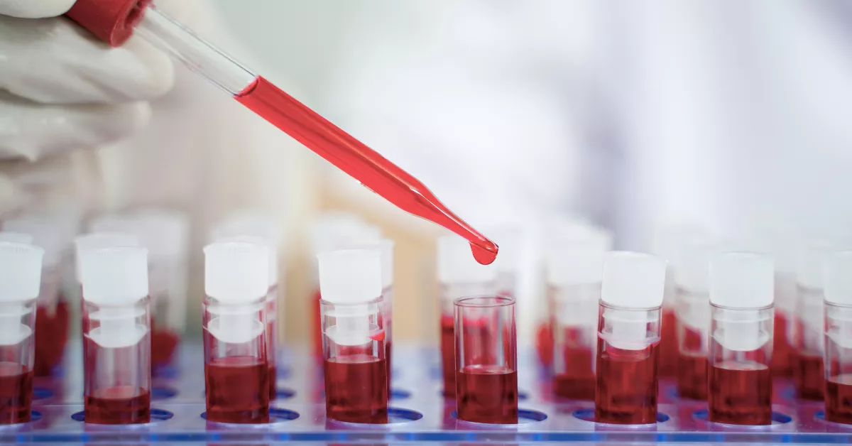 Sangre en tubos EDTA en un laboratorio. /CANVA