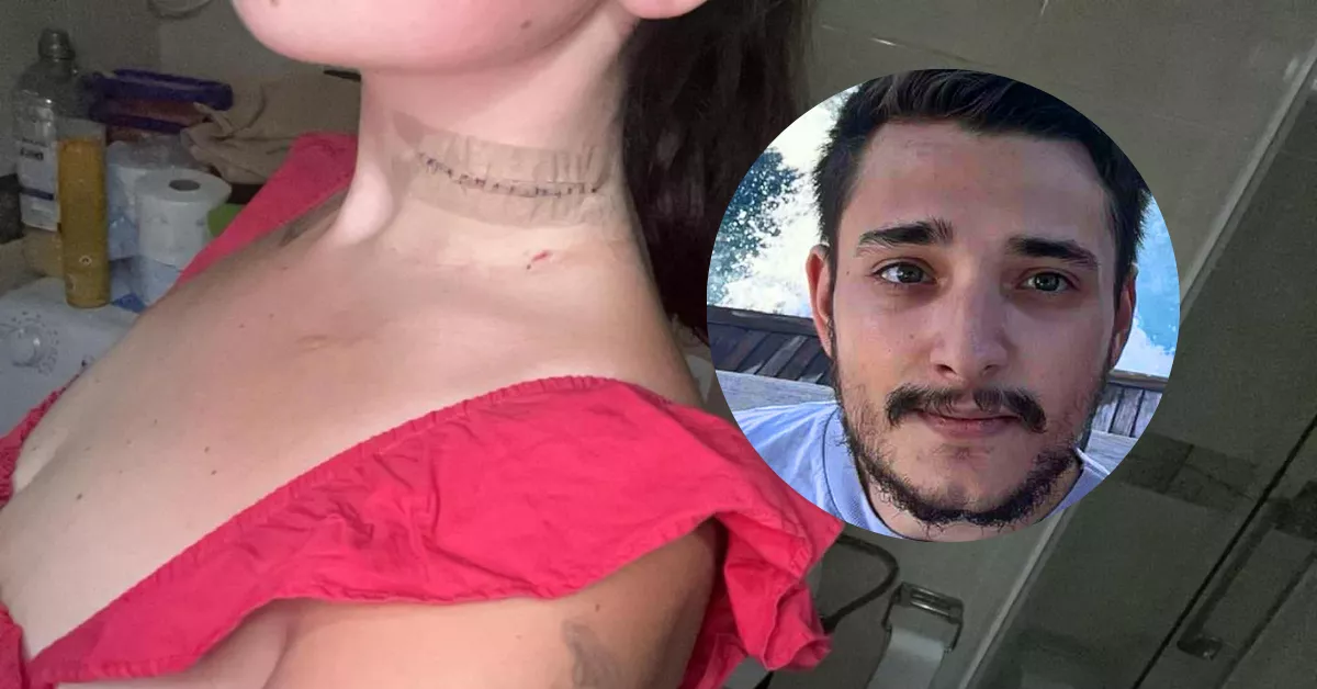 El cuello cortado de Eleanor Gilbert en Adeje en diciembre de 2024 por su pareja, Thomas Gilpin./ RRSS