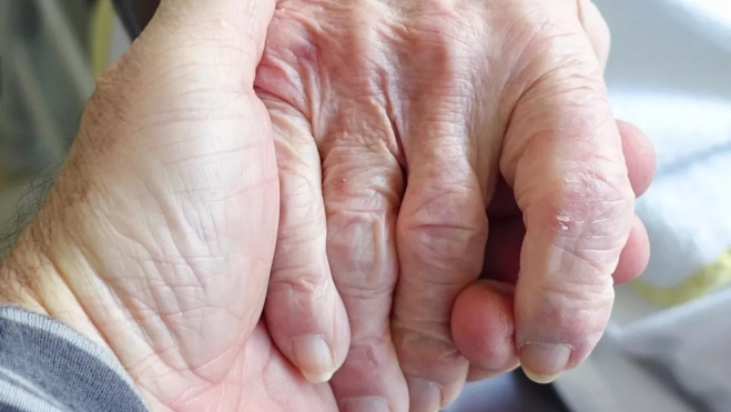 Imagen alusiva a una persona dependiente. / PIXABAY 