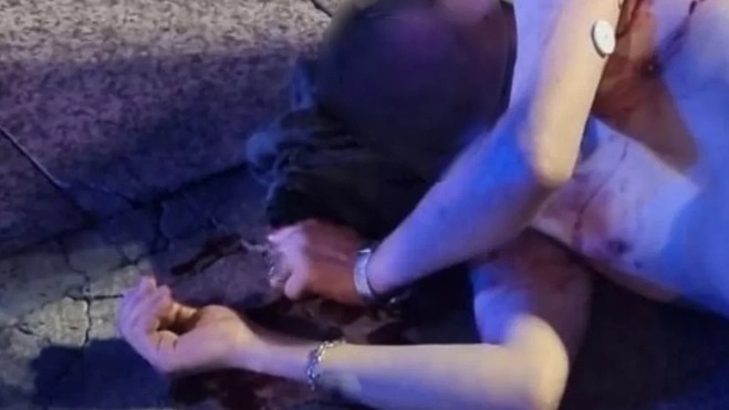 Imagen de uno de los agredidos en el Parque Santa Catalina esta madrugada / AH