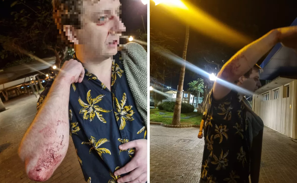 Imágenes del turista inglés agredido / AH