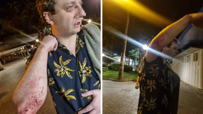 Imágenes del turista inglés agredido / AH