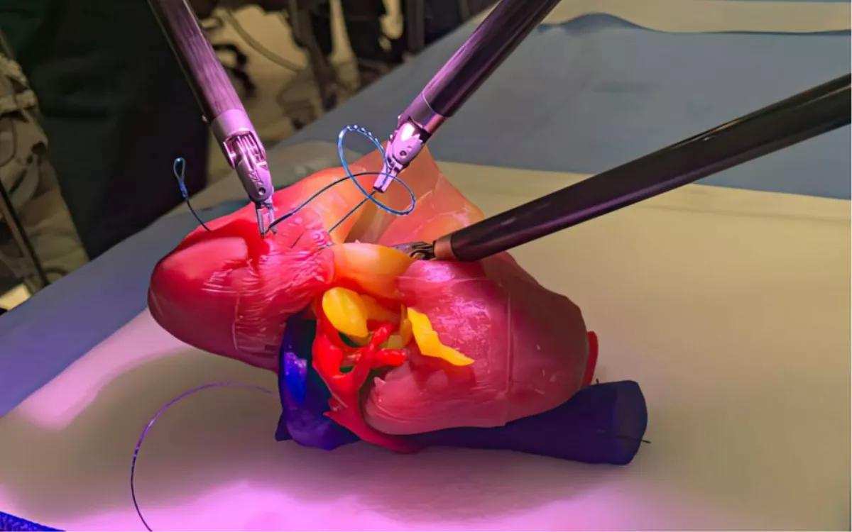 La IA no es un juego: avances reales que transforman la medicina. / AH