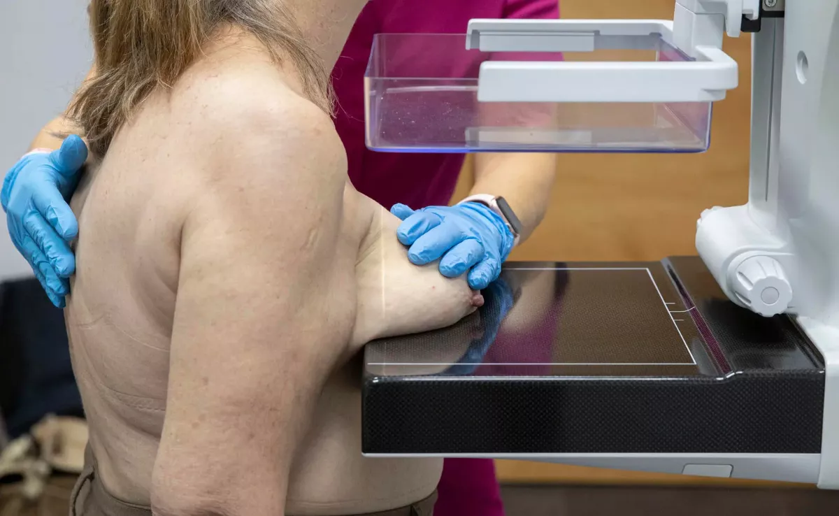 Aunque el cribado funciona bien, desde la primera sospecha hasta el tratamiento, los tiempos pueden alargarse hasta 120 días / EFE