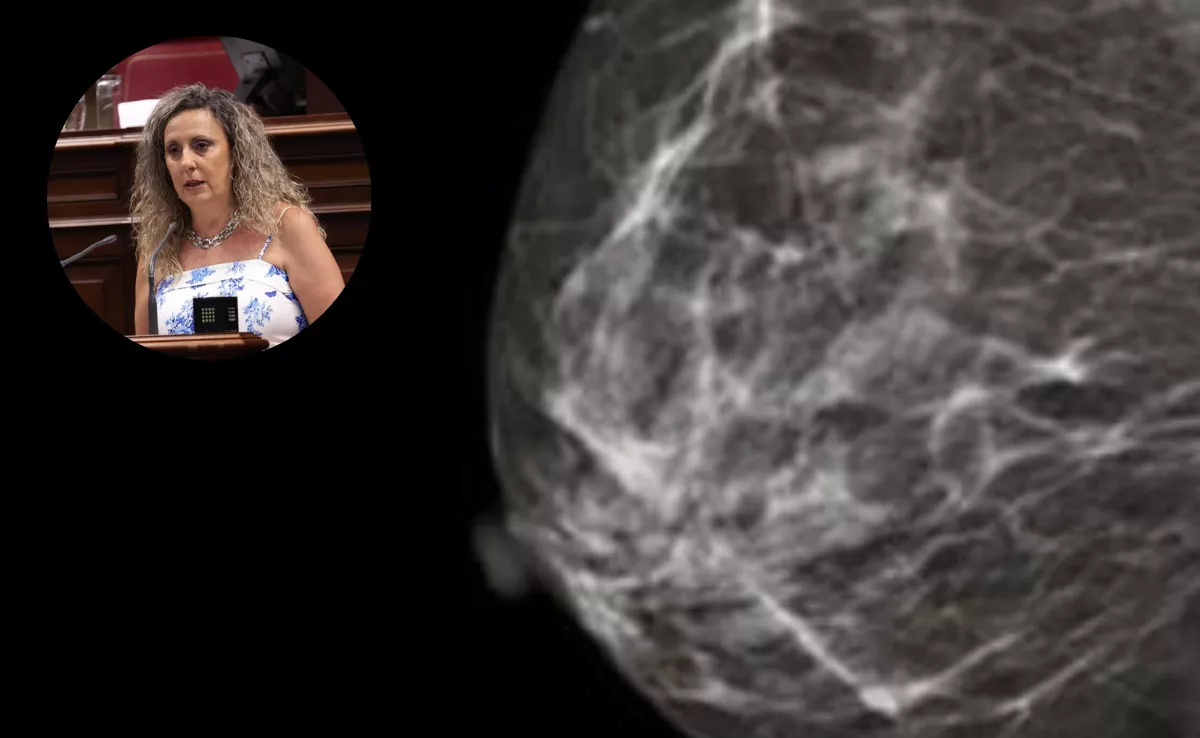 Imagen de radiografía mamaria y la diputada Marta Gómez |MONTAJEAH
