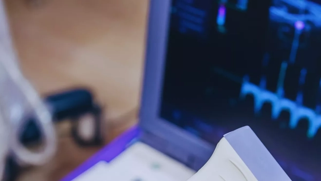 Imagen de una ecografía. / CANVA