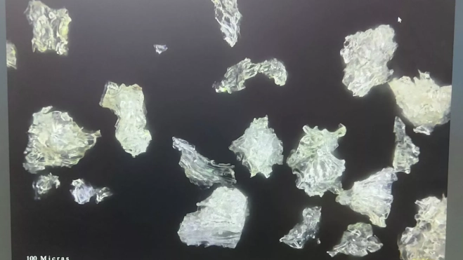 Imagen de microscopio de partículas de polvo de sílice./ CEDIDA POR BEGOÑA CORREA Imagen de microscopio de partículas de polvo de sílice./ CEDIDA POR BEGOÑA CORREA