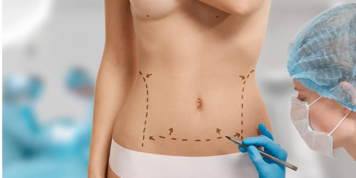Imagen de una consulta médica para abdominoplastia / MAGNIFIC