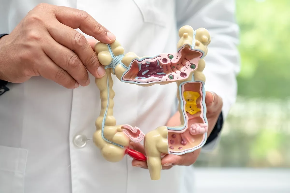 Modelo anatómico en relieve del intestino grueso (colon) y el apéndice / QUIRÓNSALUD